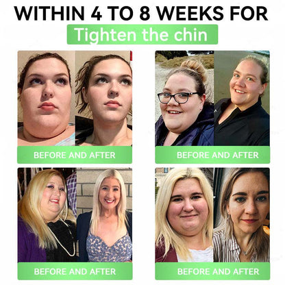 🍃Official Store | Alcuras_Moringa × Berberine × AMPK 8-Benefit Slimming & Metabolic Nano Microneedle Patch 🇺🇸  Just once a day · Visible changes in 7 days  ✅ For obesity, loose skin, diabetes, sleep apnea, joint issues