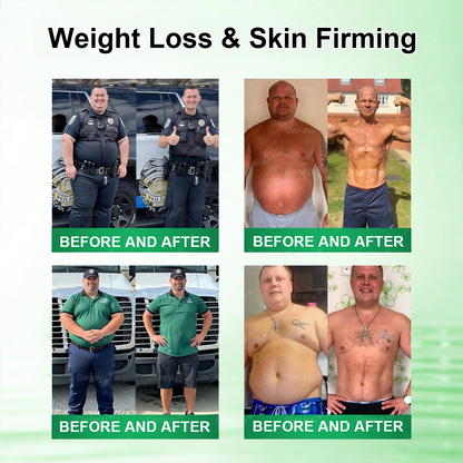 🍃Official Store | Alcuras_Moringa × Berberine × AMPK 8-Benefit Slimming & Metabolic Nano Microneedle Patch 🇺🇸  Just once a day · Visible changes in 7 days  ✅ For obesity, loose skin, diabetes, sleep apnea, joint issues